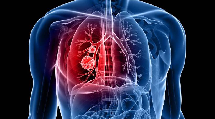 Lung Disease treatment in Manjari Pune