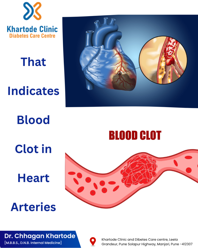 Symptoms That Indicate a Blood Clot in Heart Arteries